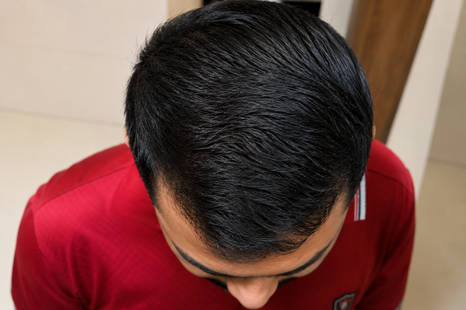 Hair Fall After image